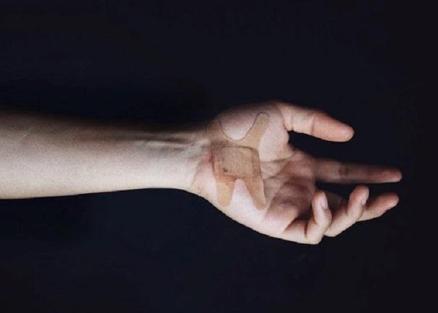 Wound classification